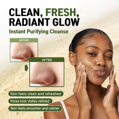Image of Korean AHA BHA PHA Exfoliant Cleansing Foam Face Wash w / Centella, Tea Tree & Green Tea, Gentle Low pH Pore Minimizer Cleaner Cleanser for Sensitive & Acne-Prone Skin, Non-Stripping & Fragrance 5 Oz