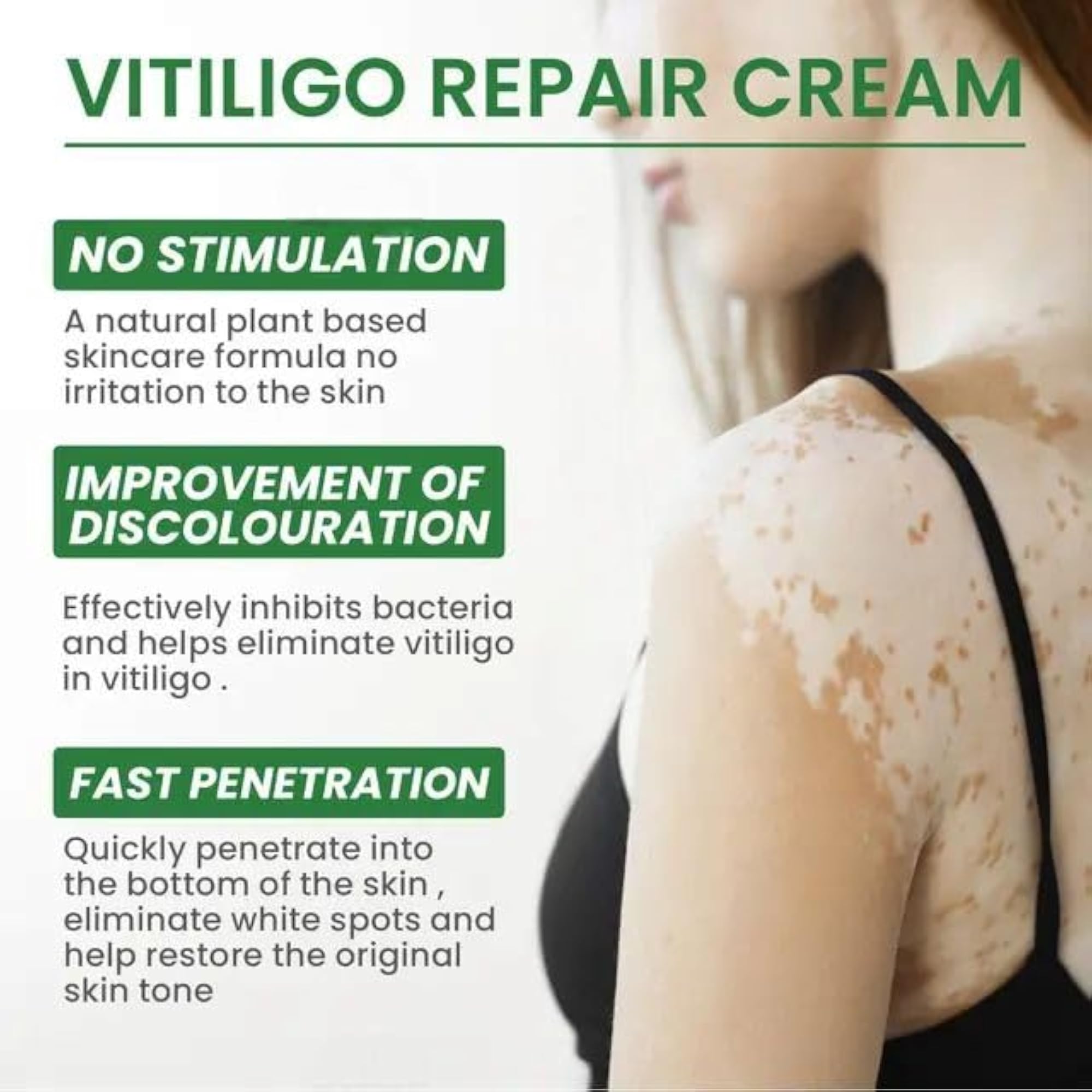 ZeroPathy Herbal Spot Care for Vitiligo, Ayurvedic Skin Tone Cream