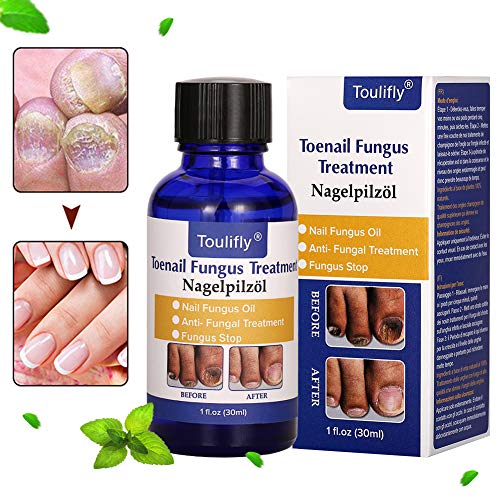 Nagelpflege und Behandlung, Nagelpflege für gesunde Fuà und Hand, Nagelpflegeöl,Nagelpflege pflegend – Bild 6