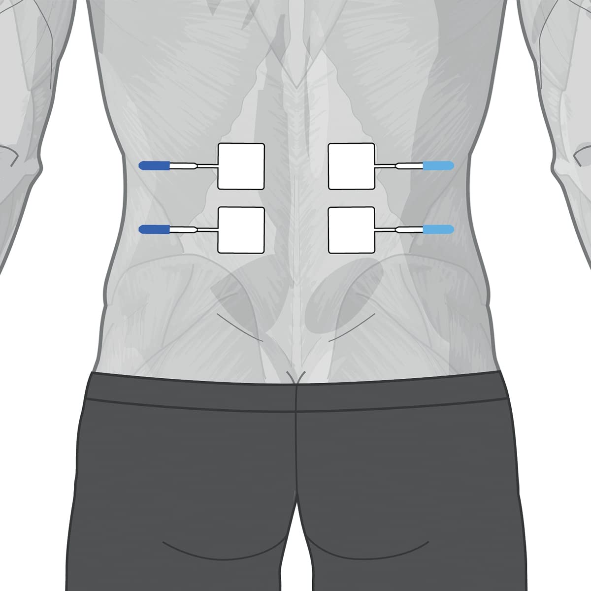GLOBUS | Genesy 300 PRO, Elettrostimolatore a 4 Canali, 91 Programmi per La Fisioterapia