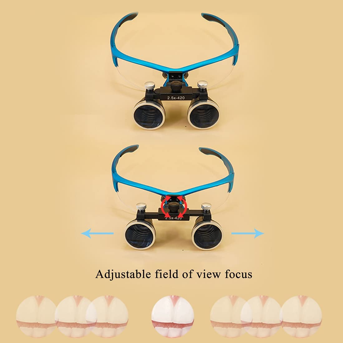 Loupes binoculaires chirurgicales antibuée pour Dentiste 2,5X 3,5X 420 mm Eclairante Lunette grossissante High Intensity LED lightdi, Loupes Jumelles Chirurgicales en Verre Optique