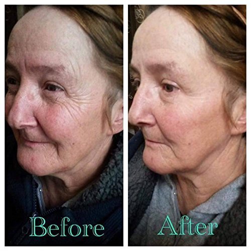 Jeunesse Instantly Ageless 10 Vial - Reduziert sofort das Aussehen von Augenbeuteln, feinen Linien, Falten und Poren und hält 6 bis 9 Stunden