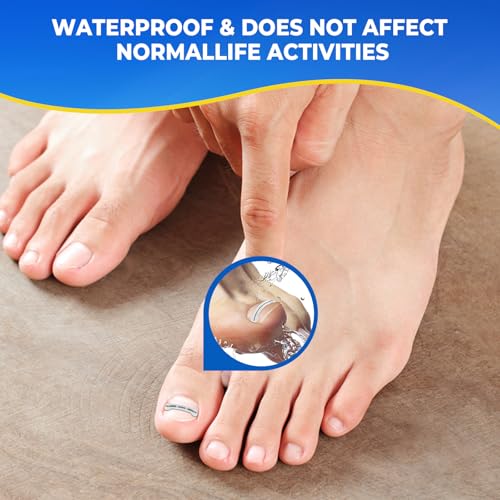 Correcteurs pour ongles incarnés Souvik pour marcher confortablement - 7