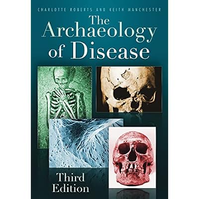 The Archaeology of Disease