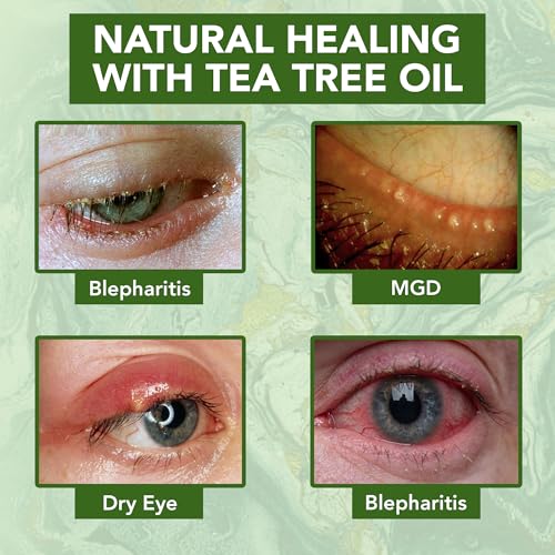 Noveha Tea Tree Oil Anti Wrinkle Eye Cream thumb #3