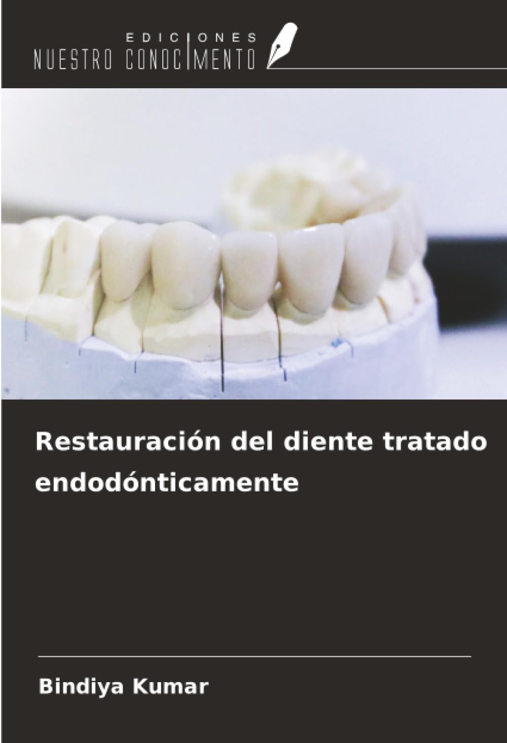 Restauración del diente tratado endodónticamente