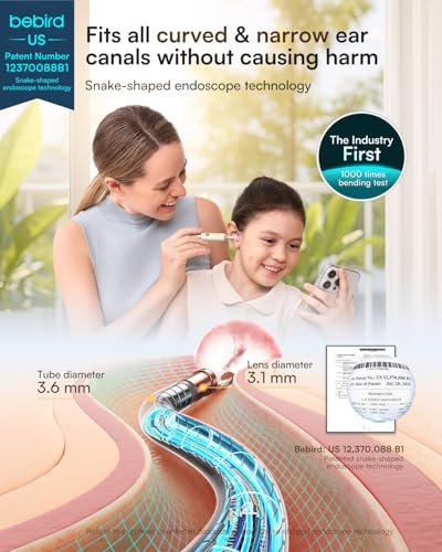 Image of Bebird Earsight Ultra 2K Ear Wax Removal Tool Camera,Pain-Free Ear Cleaner with HD Otoscope,Visual Ear Pick Tweezers, Safe Silicone Tips,Ear Cleaning Kit for Family, FSA HSA Eligible (Champagne Gold)