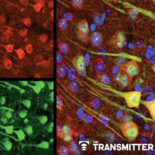 Aging neurons outsource garbage disposal, clog microglia