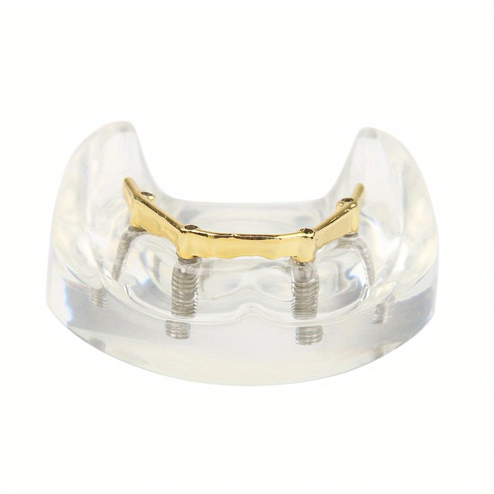 Transparent Dental Lower Jaw Implant Model Dental Demonstration Model for Education and Study Model Tool, Golden
