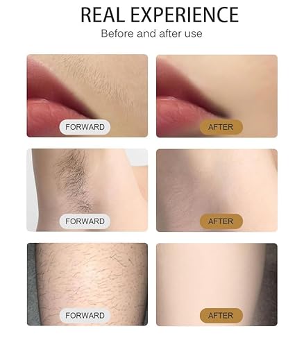 755/808/1064nm Soprano Ice Titanium Painless Diode Hair Removal Machine beauty salons, or personal home care. - Image 7