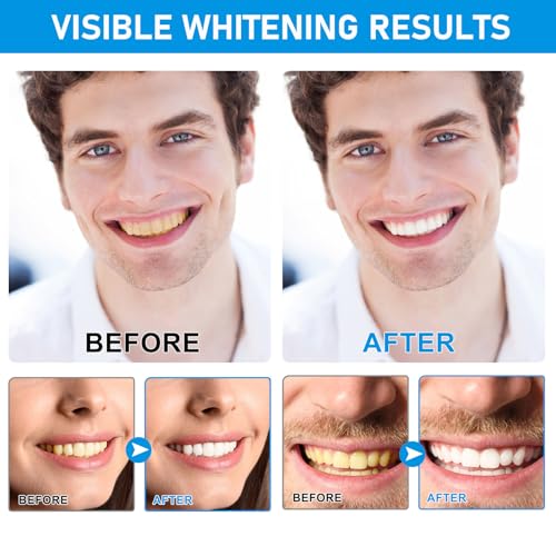 Image of Teeth Whitening Powder with Hydroxyapatite - Tooth Powder for Surface Stain Removal - Fresh Mint Formula for Coffee & Tea Stains - Enamel-Friendly Whitening Powder for Sensitive Teeth