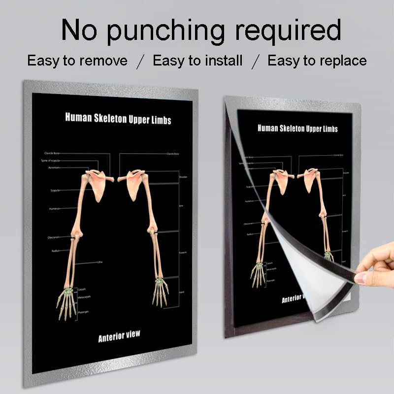 Image of Taanfu Body Educational Learning Anatomy Posters ，Skeleton Upper Limbs Art Skeleton Villi Anatomy Art Poster Digestive System Organs Illustration Small Intestine Physiology Anatomy Wall Art Villi