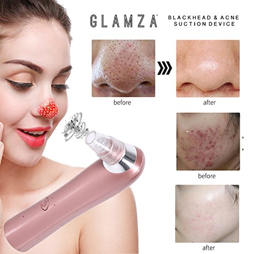 Miniatura 9 de Máquina de succión facial eléctrica del acné del poro