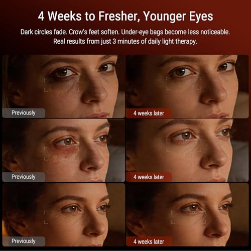 Image of Red Light Therapy Mask - Red Light Therapy for Eyes with 3-Minute, 4 Wavelengths, Targets Wrinkles, Fine Lines, Dark Circles & Eye Bags, Women Men for Home & Travel (Black)
