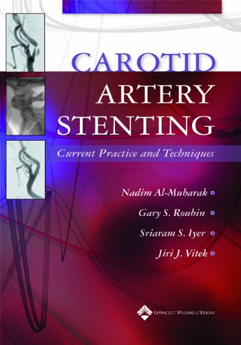 Buy Carotid Artery Stenting: Current Practice and Techniques — BookShops.in