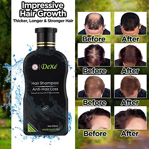 Tssplus Dexe 200Ml Anti-Hair Loss Hair Growth Shampoo,Hair Loss,Hair Growth,Hair Regrowth Shampoos,Serum,Herbal,Liquid,Avoid Hair Loss Unisex,Vitamins Treatment Natural Ingredients #TOP1