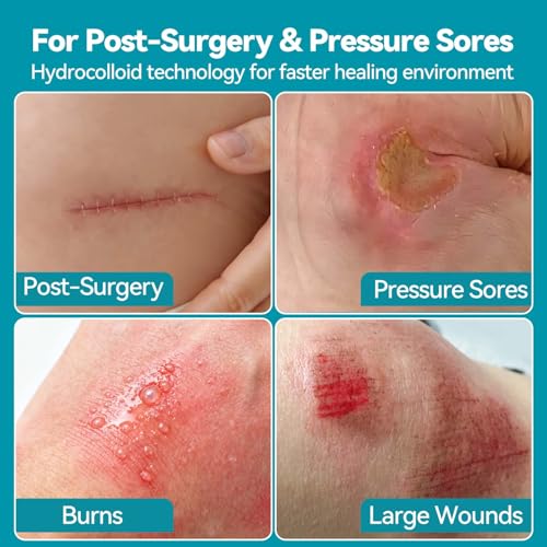 Image of Dimora 4 inch x 4 inch Hydrocolloid Dressing Tapered Edges for Wound Care, 10 Pcs Large Hydrocolloid Bandages for Burn, Blister, First Aid Kit Essential Wound Dressing