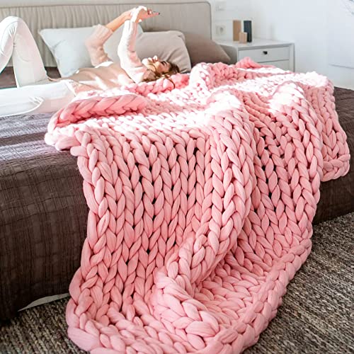 Chunky Yarn For Arm Knitting, Giant Soft Fleece Yarn Bulky Yarn For Throw Blanket Pillow For Weave Craft Crochet, Diy Sofa Bed Blanket Pillow Pet Bed And Bed Fence (Pink-(2.2Lbs)) #TOP3