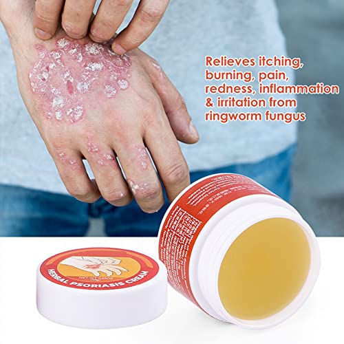 Ysgbysg Skinmedix Psoriasis Herbal Treatment Cream, Skinmedix Psoriasis Cream, Natural Chinese Herbal Cream, Anti-Itch Cream Ointment For Face And Body (5Pcs) #TOP6