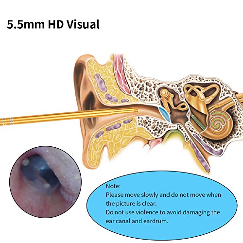 Exblue Plettro per Orecchie Digitale, endoscopio