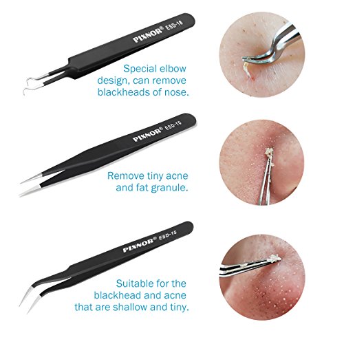 PIXNOR Precision Tweezers Set - 10 PCS ESD Tweezer Set, Anti-Static Stainless Steel Tweezers Kit Curved Tweezers for Craft, Jewelry, Electronics, Laboratory Work - Thumbnail 3