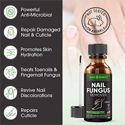 All Natural Nail Fungus Treatment – Made in USA, Best Nail Repair Product, Stop Fungal Growth, Effective Fingernail & Toenail Solution, Fix & Renew Damaged, Broken, Cracked & Discolored Nails