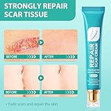 Zoom IMG-1 20g cicatrici gel crema cura Zoom IMG-1 20g cicatrici gel crema cura