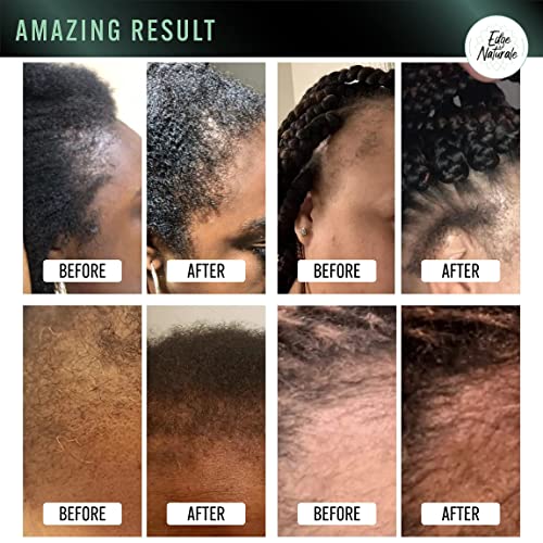 Edge Naturale Follicle Enhancer For Natural Edges, Repair And Regrow Hair Edges, For All Hair Types, Growth Treatment For Women, Made In The Usa, 4 Ounce #TOP2