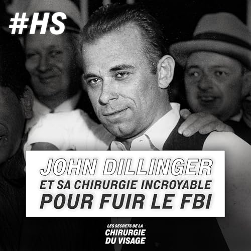 [HORS-SÉRIE] - LE GANGSTER JOHN DILLINGER ET SA CHIRURGIE INCROYABLE POUR FUIR LE FBI
