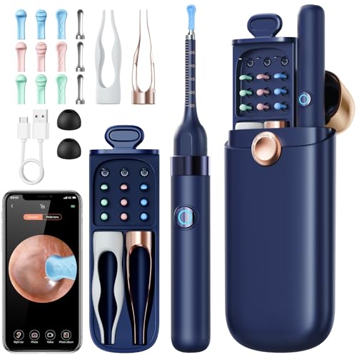 Qimic Ear Wax Removal Tool Camera, Safe Tweezers Wax Cleaner with 12 Ear Scoops, Full ENT Observation Tools for Ear, Nose & Throat, Kids & Adults, Portable with Storage Case