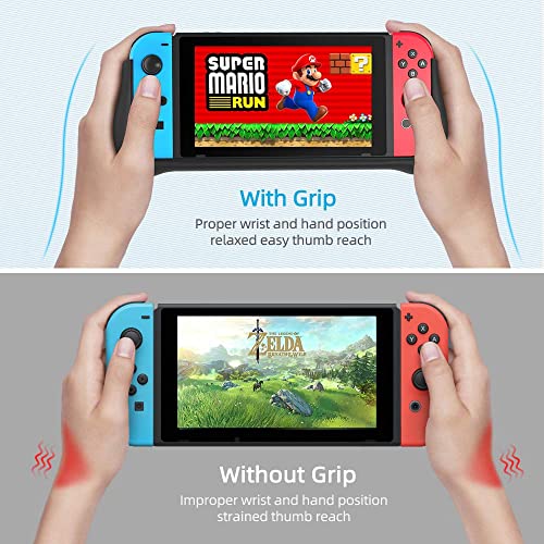 Newdery External Battery Station For Nintendo Switch (6.2" Lcd Model), 10000Mah Backup Charger Case Support Pd Quick Charging With 2 Extra Game Card Slots Adjustable Kickstand For Nintendo Switch #TOP6