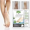 Foot-Peel-Mask-5-PACK-Foot-Mask-for-Dry-Dead-Skin-Callus-Repair-Rough-Heels-Make-Your-Feet-Baby-Soft-Get-Smooth-Silky-Skin-Natural-Treatment-Aloe Foot Peel Mask - (5 PACK) Foot Mask for Dry Dead Skin, Callus, Repair Rough Heels - Make Your Feet Baby Soft Get Smooth Silky Skin - Natural Treatment (Aloe)