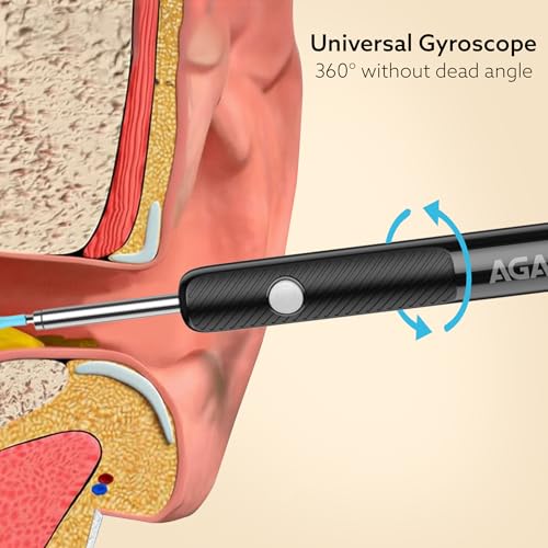 Image of AGARO Regal Ear Endoscope Cleaner /Earwax Removal Tool Kit with HD Camera, Light Weight, Type-C Charging, 130 mAh Battery, IP67 Waterproof, Wifi Connection for iOS & Android + 6 Silicone Tips