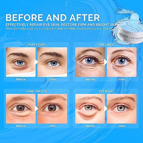 Enaskin Naturals Under Eye Patches For Dark Circles: 30 Pairs Retinol Collagen Eye Gels Mask thumb #1
