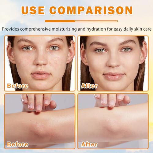 IONSGAKO 5PCS Vitamin C Skin Care Set for Teenage Girls Face Hydrating Skincare Gift Set for Women Travel Size Skin Care Kit with Cleanser, Toner, Face Serum, Eye Cream, Face Cream