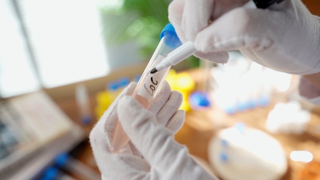 Image of Konohan 400 Pack 15 Ml Centrifuge Tubes Sterile Plastic Test Tubes
