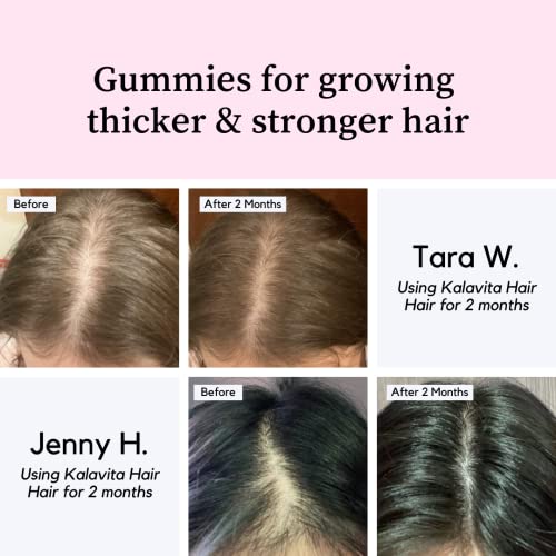 Kalavita Eye Health Bling + Hair Skin & Nails Bundle Sugar Free Gummy Vitamins | Lutein & Zeaxanthin, Biotin, Vitamin A, C, E, B5, And D #TOP3