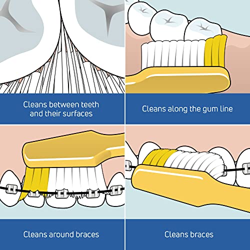 TEPE Nova Zahnbürste Medium Für eine effektive und gründliche Zahnreinigung x Bürste in Gelb – Bild 5