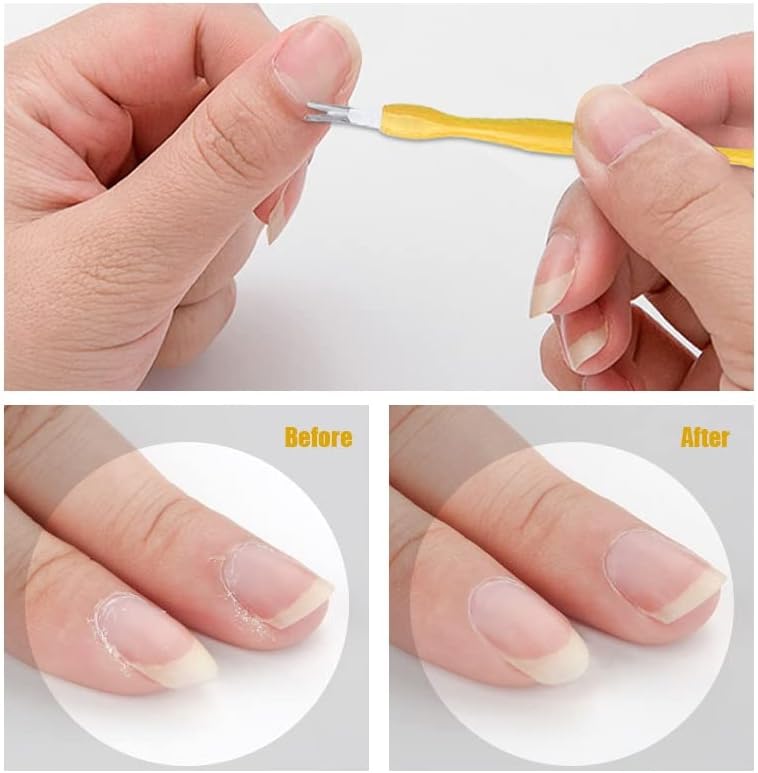 10 in 1 Professional Pedicure Tools Foot Rubbing Board Set Foot Grinding Dead Skin Pedicure Exfoliating Tool for Foot Skin Care image 5