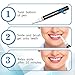 GlorySmile Teeth Whitening Kit with LED Light, 16 Min Non-Sensitive Fast Teeth Whitener with 3 Carbamide Peroxide Teeth Whitening Gel Pens, Helps to Remove All Kinds of Stain