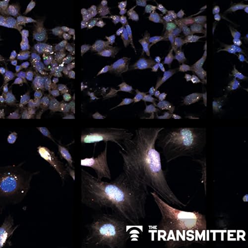 Signs of aging vary across brain cells