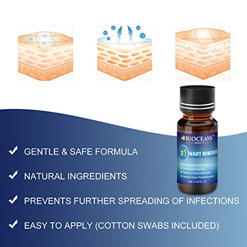 Wart Removal, Corn Removal, Painless Removal of Plantar, Common Warts and Infections, Promotes The Healing of Calluses and Corns(10ml)