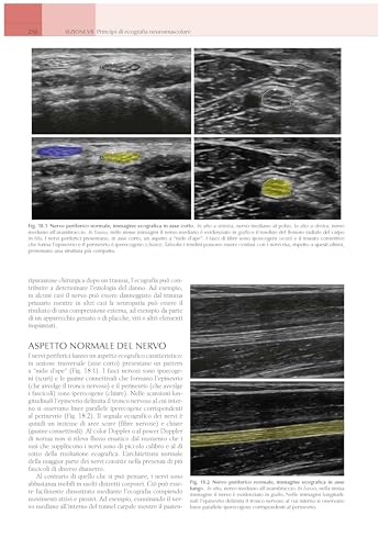 Elettromiografia E Disordini Neuromuscolari. Correlazioni Clinico-Elettrofisiologiche Ed Ecografiche - 3