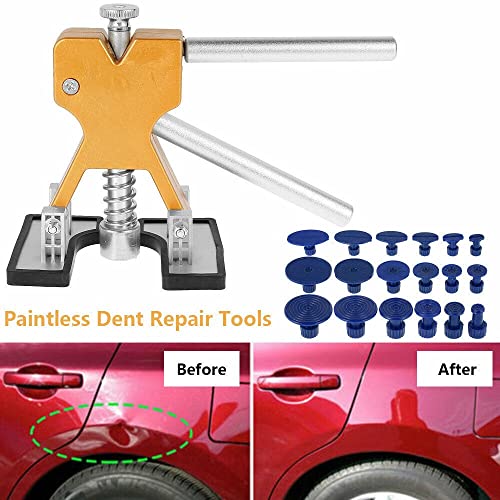 QOXEZY Kit di riparazione per ammaccature, senza