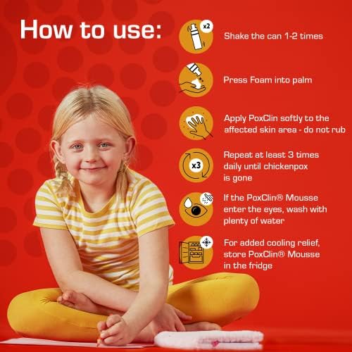 PoxClin CoolMousse Chicken Pox Treatment for Children - Chicken Pox Relief Kids - Relieve Symptoms and Itch of Chickenpox - Natural Ingredients - Cool Mousse Chicken Pox Cream Alternative - 100 ml