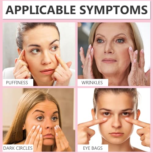 Jasminsalbe Plus,100ml Jasmin Salbe Augen, Augencreme Augenringe Schlupflider, Gegen Falten Augenstraffung Jasmin Creme, Entfernen Tränensäcke und Schwellungen Collagen Eye Cream