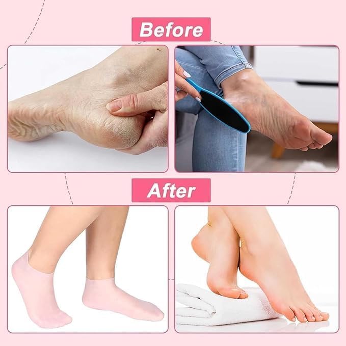KEMLOZE Silicone Socks For Women, Moisturizing Foot Socks, Soft Gel Socks, Aloe Socks, Women Spa Pedicure Socks Multicolor (Silicon socks, 1, count) (Thin Gel Socks, 1 Pair, Pink) 4