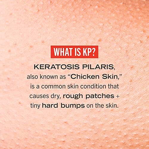 First Aid Beauty KP Bump Eraser Body Scrub, Exfoliant for Keratosis Pilaris with 10% AHA, 2 oz