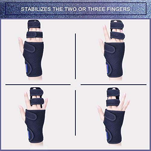 Trigger Finger Splint for Two or Three Finger Immobilizer - Post Operative Care Support for Broken Joints, Sprains, Contractures, Arthritis, Tendonitis and Pain Relief (LEFT, S/M), - Thumbnail 2