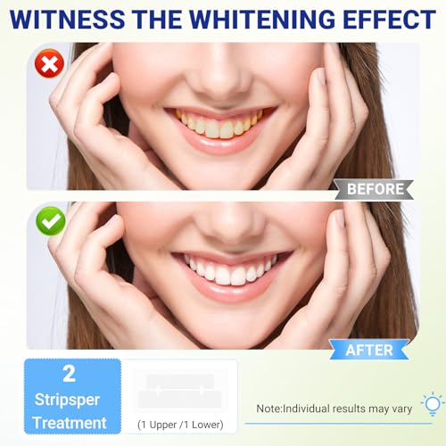 14 Day Teeth Whitening Strips Kit,28 Strips (14 Treatments),Non-Slip Enamel-Safe Strips for Whiter Teeth (1 Count (Pack of 14)) - Image 3